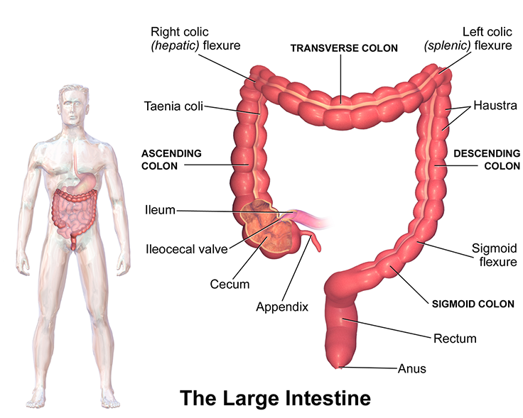 colorectal cancer largeintestine2