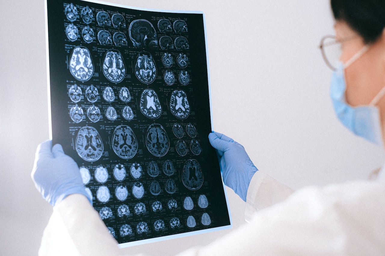 Causes and Risk Factors of Brain Cancer | Clearview Cancer Institute